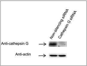 GenomONETM-Neo EX 仙台病毒包膜（4只装）转染试剂