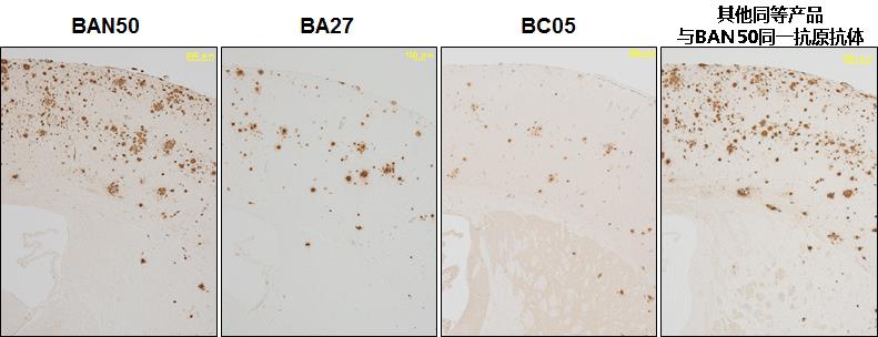 抗β-淀粉样蛋白抗体（BAN50/BNT77/BA27/BC05）